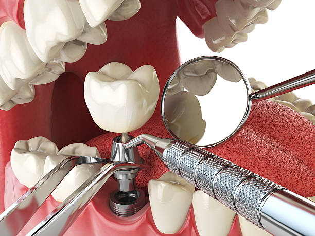 Best Root Canal Emergency Dentist  in Madisonville, TN